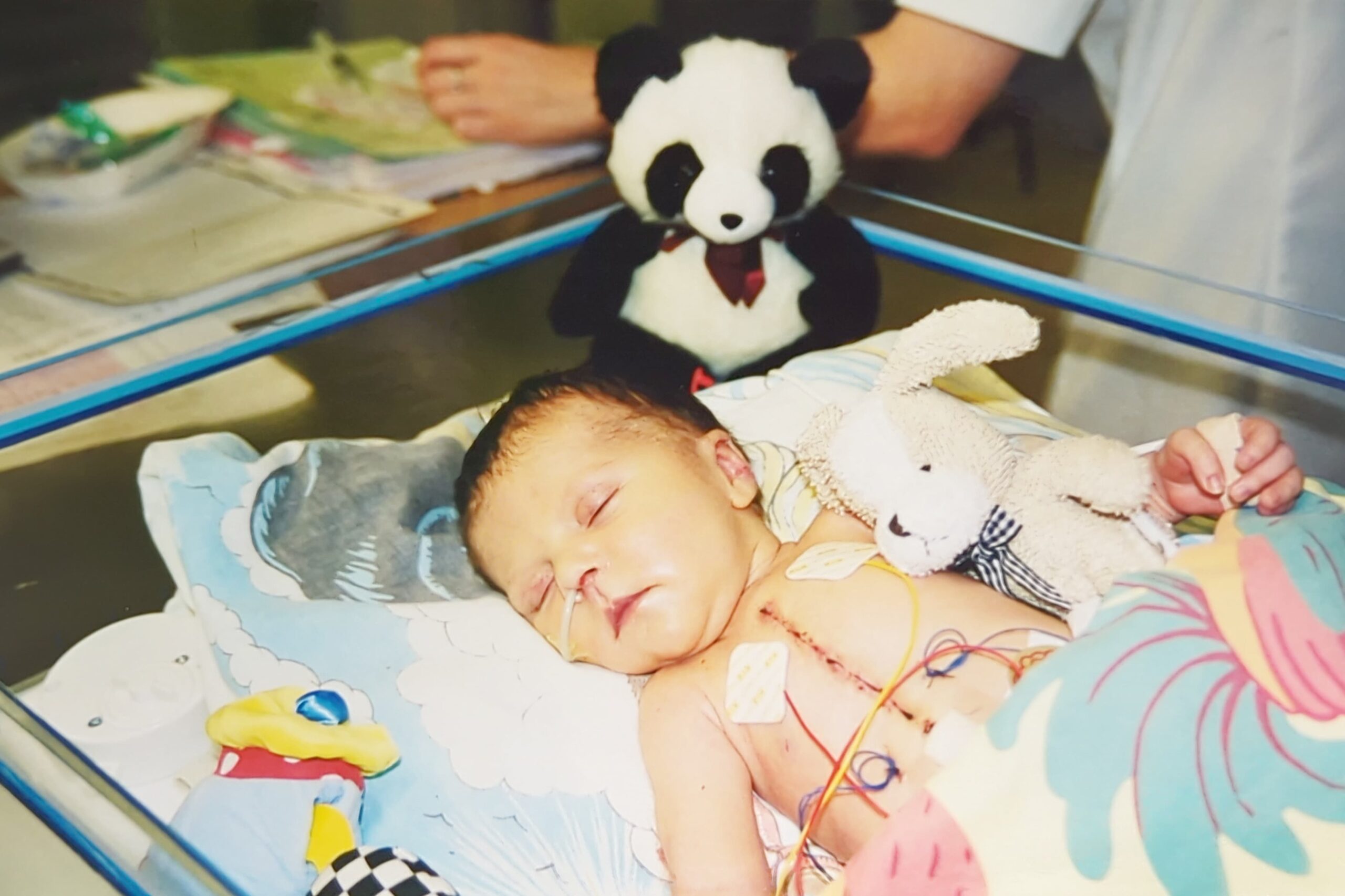 Baby Joanna lies sleeping in a hospital cot with medical wires attached to their chest and a healing surgical scar down the centre. A soft toy rabbit rests beside the baby, and a stuffed panda sits at the head of the cot. Medical equipment and a person’s hands are visible in the background.