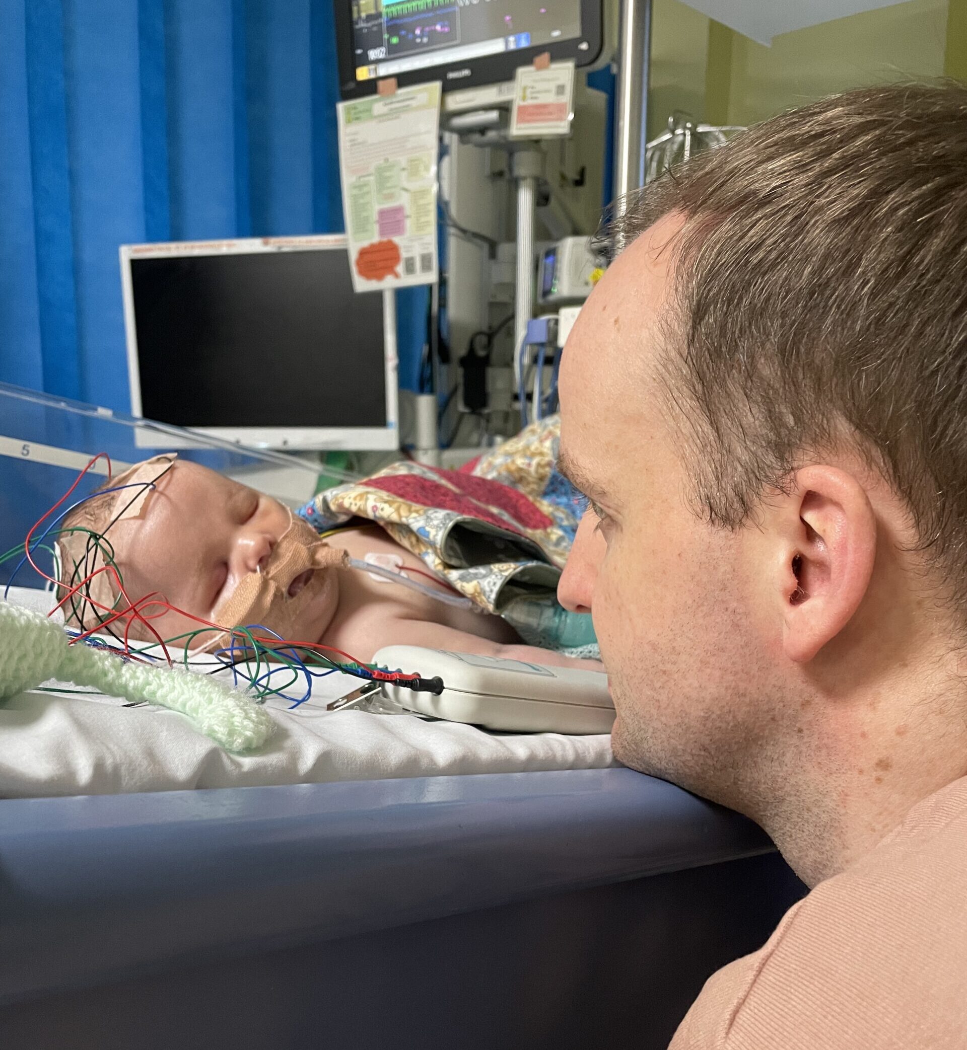 Baby Albie in hospital with Dad Tom. Albie is connected to medical equipment with wires and tubes